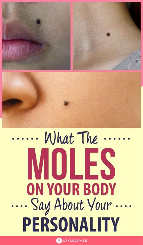 Here Is What The Moles On Your Body Say About Your Personality Moles