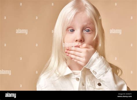 Surprised Or Scared Little Albino Girl Close Her Mouth Look At Camera