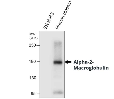 Alpha 2 Macroglobulin Antibody 15a04 1g3 Irm204 Ireal Biotechnology Inc