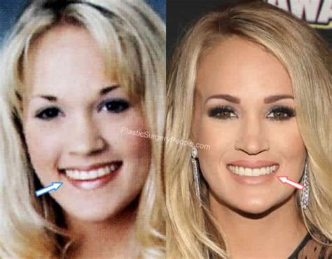 Carrie Underwood Before And After