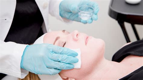 The Top Faqs About Chemical Peels Mint And Needle