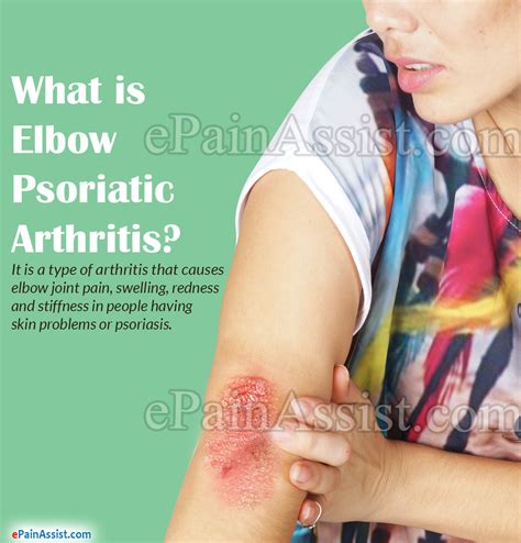 Elbow Psoriatic Arthritistypescausessymptomstreatmentprognosisfaq