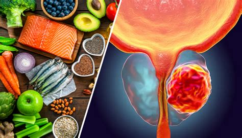 5 Foods That May Help Protect Your Prostate