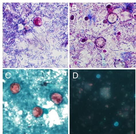 When viewed under the microscope, oocysts will appear pink/red in color. Cyclospora Detection and Reporting from Clinical Samples ...