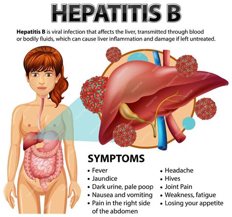 Síntomas De La Hepatitis B Vector Premium
