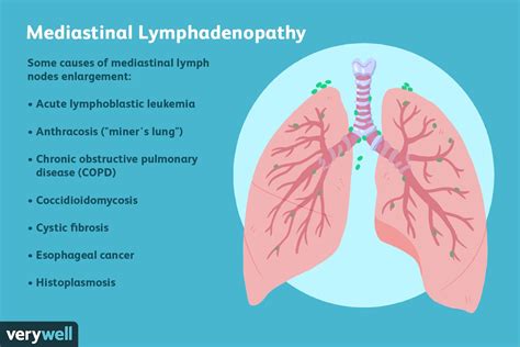 Mediastinal Lymphadenopathy