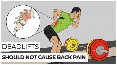 Why Back Pain From Squats And Deadlifts Main Causes