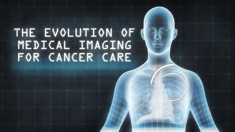 The Evolution Of Medical Imaging For Cancer Care Youtube