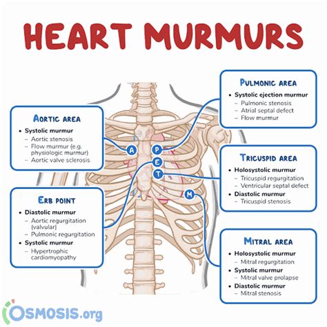 Auscultation Sites Of Heart Murmur Medizzy