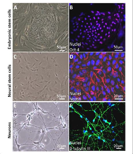Differentiation Of Human Embryonic Stem Cells Hescs Into Neural Stem