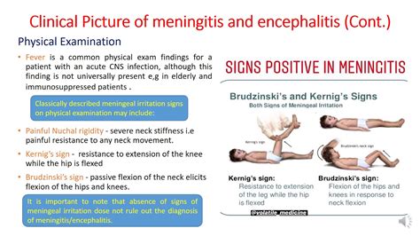 Meningitis And Encephalitis Lecture 11 Profdrehab Elseidy Youtube