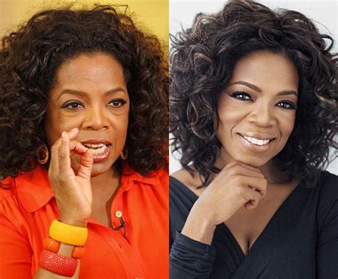 Oprah Winfrey Nose Job Before And After Photo In 2021 Nose Job