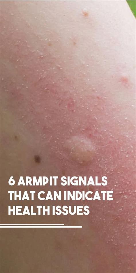 6 Armpit Signals That Can Indicate Health Issues Medical Problems