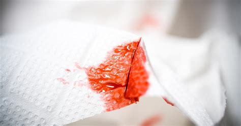 Dont Mistake Your Implantation Bleeding For Period