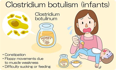 Botulism Serum Therapy