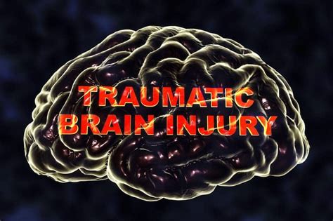 Blood Test Traumatic Brain Injury Axis Imaging News