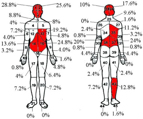 Pain Locations On Body Diagram Open I