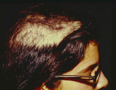 Кто вылечил гастрит диетой