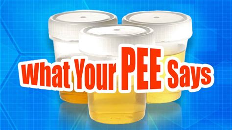 What Your Pee Says About You Learn What Your Urine Reveals