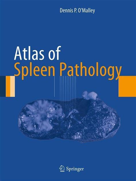 Atlas Of Anatomic Pathology Atlas Of Spleen Pathology Ebook Dennis