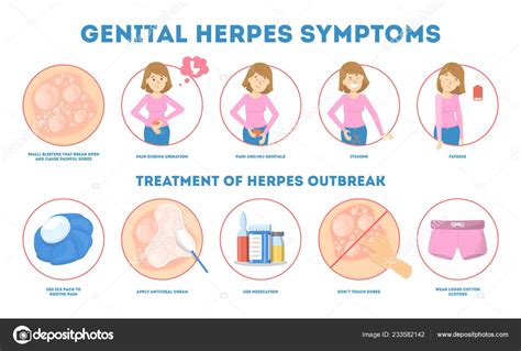 Genital Herpes Symptoms Infectious Dermatology Disease Illustration Stock Vector Inspiring