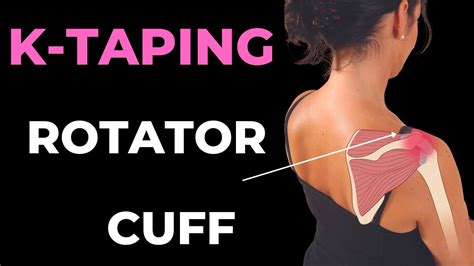 Kinesiology Taping For Shoulder Pain How To Apply 49 Off