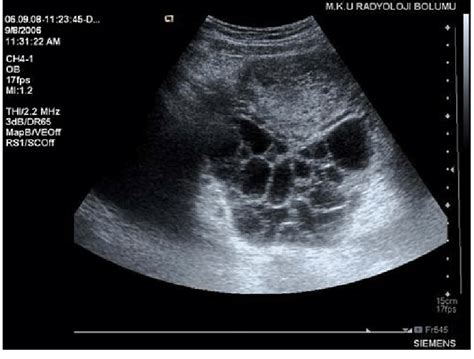 Pin On Pelvic Ultrasound Female