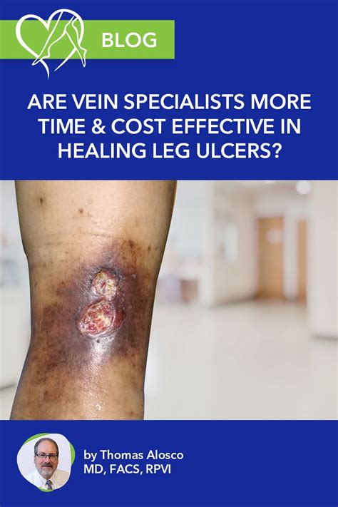 Are Vein Specialists More Time And Cost Effective In Healing Leg Ulcers