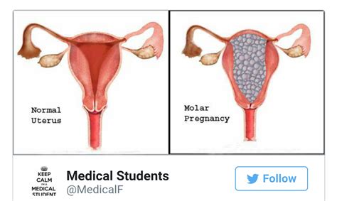 Our mission is to assist you with life. Welcome To Chitoo's Diary.: Wife takes a positive ...