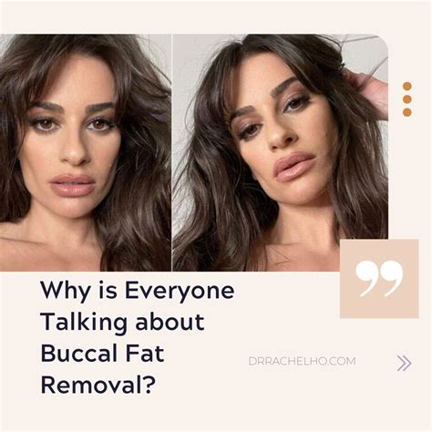 Dr Rachel Ho Why Is Everyone Talking About Buccal Fat Removal