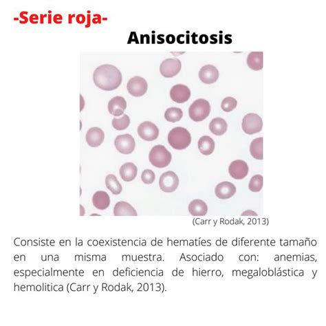 Anisocitosis Hematología Histología Celulas Sanguineas