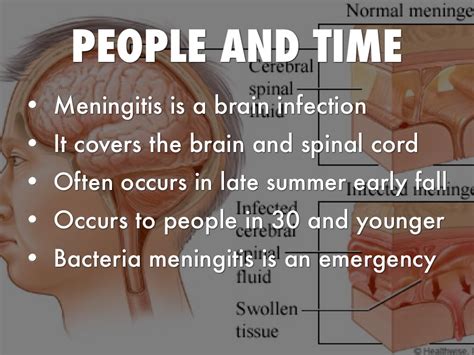Meningitis By Justin Machen