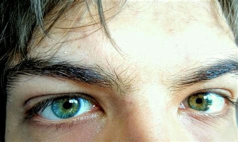 My Blue Green Heterochromia With Central Heterochromia Blue Eyes