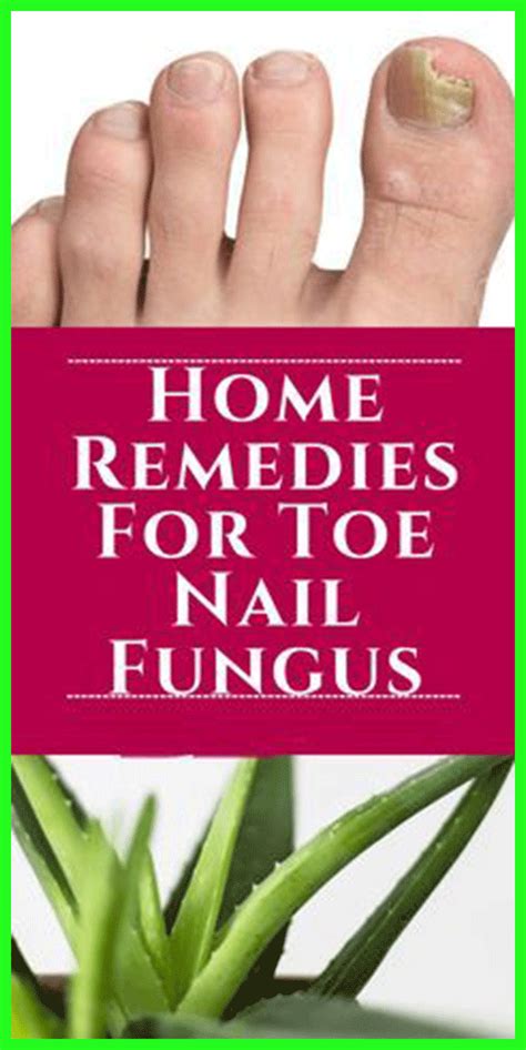 Home Remedies For Toe Nail Fungus Nail Fungus Toenail Fungus