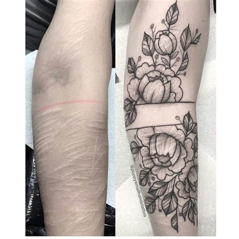 Can You Tattoo Over Scars