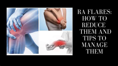 Rheumatoid Arthritis Flares How To Reduce Them And Tips To Manage Them