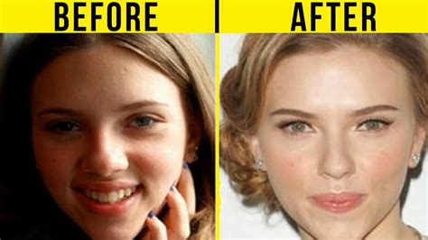 5 Best Celebrity Nose Jobs In Hollywood Before And After Youtube