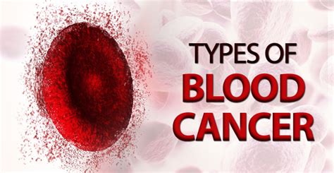Amri Hospitals Blood Cancers Symptoms Diagnosis And Treatment