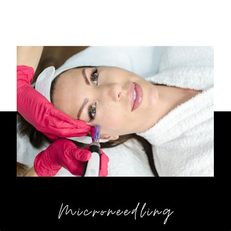 Microneedling Benefits 6 Reasons Youll Love This Non Surgical Skin Treatment