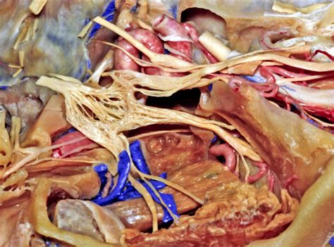 Middle Fossa and Cavernous Sinus Anatomy | Neuroanatomy | The