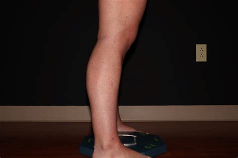 Before And After Early Stages Of Lipedema