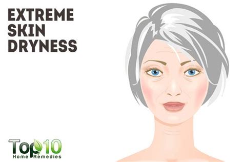 10 Things No One Ever Tells You About Menopause Top 10 Home Remedies