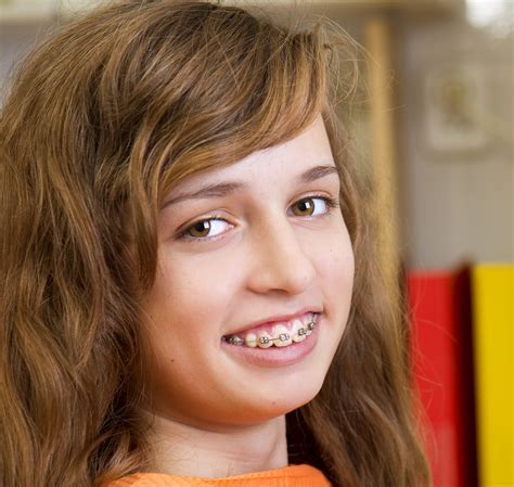 Teenage Girl With The Braces On Her Teeth Is Having A Treatment At