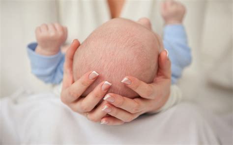 Kepala Peyang Pada Bayi Ini Penyebab Dan Cara Mengatasinya