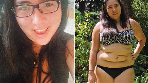 Pictured Brave Woman Left With Deep Surgery Scars Posts Bikini Photo