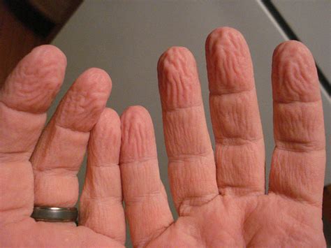 science explains the reason your hands get wrinkly after exposure to water