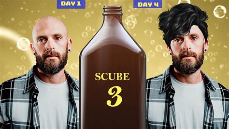 Will SCUBE 3 End Hair Loss? [ Huge Breakthrough] - YouTube