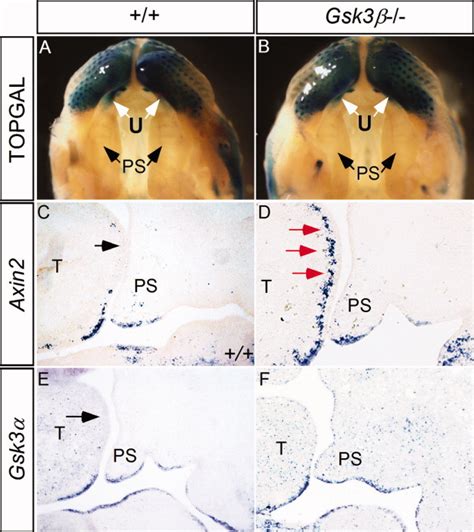 Gsk3β Is Required In The Epithelium For Palatal Elevation In Mice He