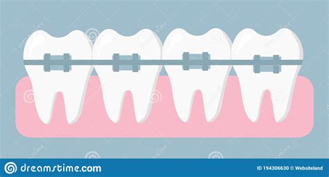 Orthodontic Treatment Braces On Your Teeth Concept Of Dentistry And Medicine Vector