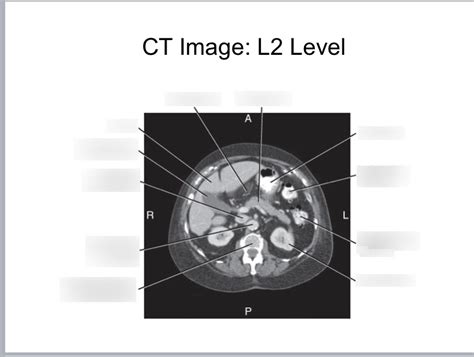 Abdominal Radiography Ct Image At L2 Level Diagram Quizlet
